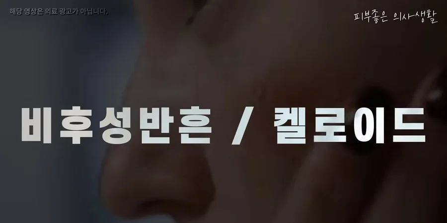 비후성 반흔과 켈로이드를 다룬 유정민 대표원장 영상의 한 장면