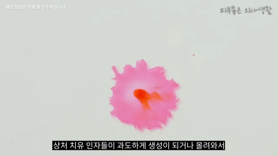 상처를 회복시키는 인자가 한곳에 과하게 몰리는 모습을 잉크 번짐으로 표현한 화면