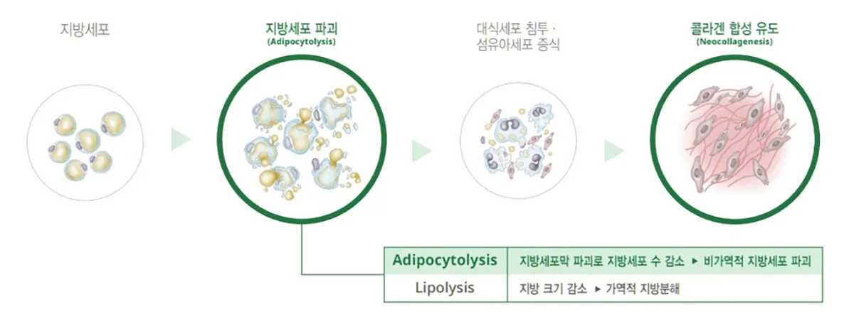 지방세포가 파괴되고 대식세포와 섬유아세포가 모인 뒤 콜라겐 합성이 유도되는 데옥시콜산 작용 과정