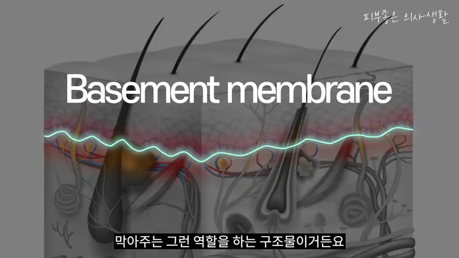 표피와 진피 사이에서 멜라닌이 진피로 내려가지 않도록 막아 주는 기저막을 표시한 피부 단면 그림