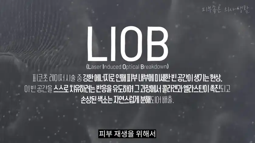 피코초 레이저의 강한 에너지가 피부 속에 미세한 빈 공간을 만들고 콜라겐 재생과 색소 배출을 이끄는 LIOB 현상 설명 화면