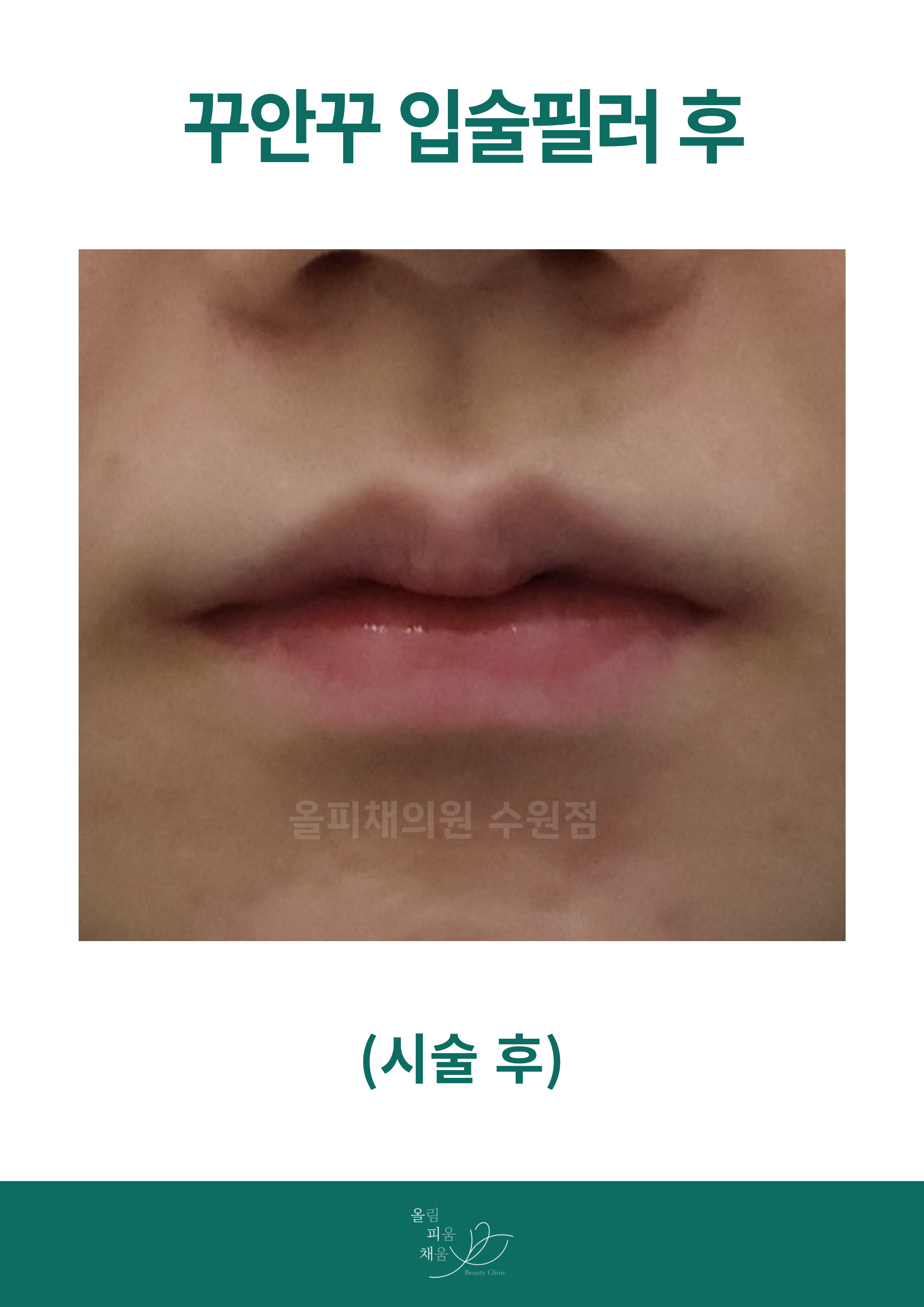 after