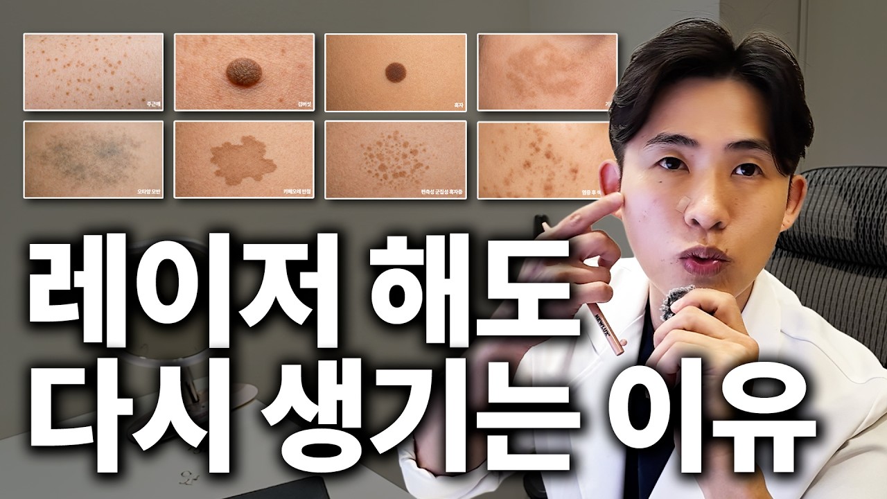 기미와 검버섯은 치료 기간부터 다릅니다, 색소 일곱 가지 정리