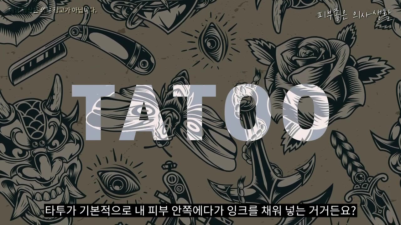 수원 문신제거, 피코슈어로 지우기 전 알아야 할 원리·횟수·가격