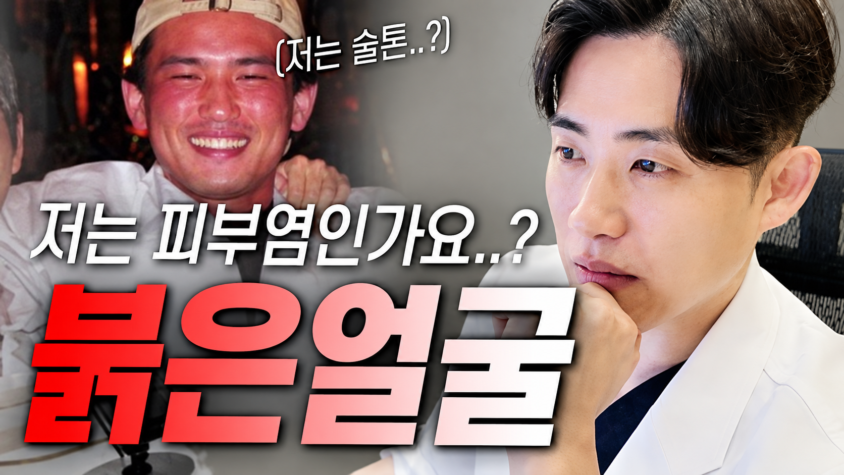 수원망포 홍조, 피부염과 혈관 문제에 따라 달라지는 치료 방향