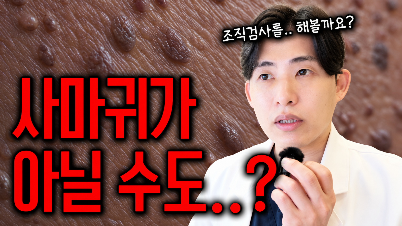 수원 편평사마귀, 얼굴의 오돌토돌한 돌기부터 구분해야 하는 이유
